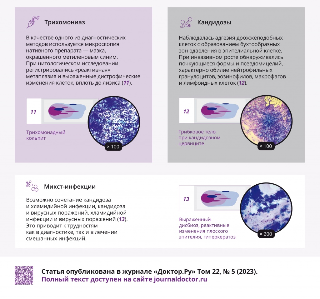 infographics_DoctorRu_vol22_No5_2023_Cytomorphological_Diagnostics-4.jpg